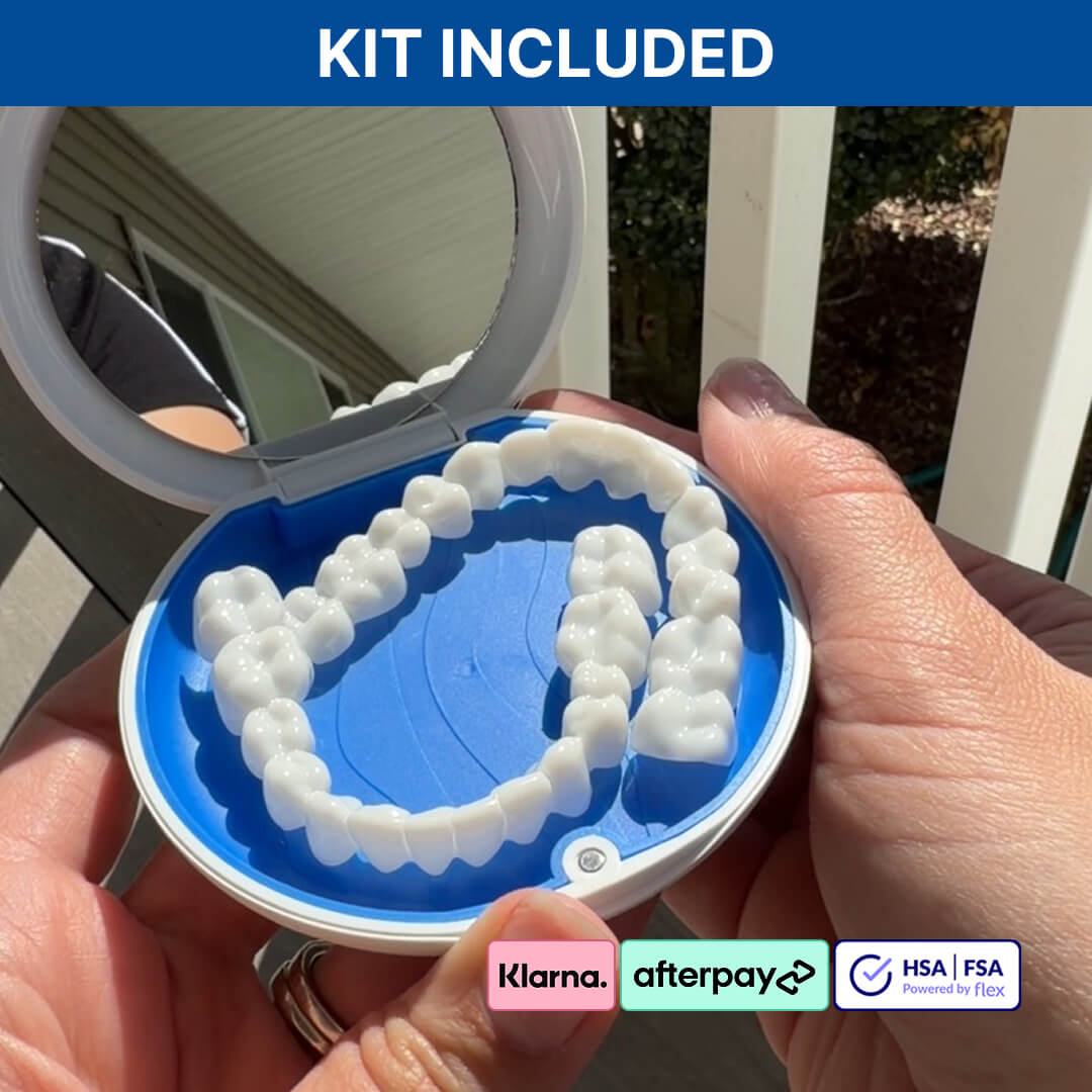 Shiny Smile Snap-On Veneers