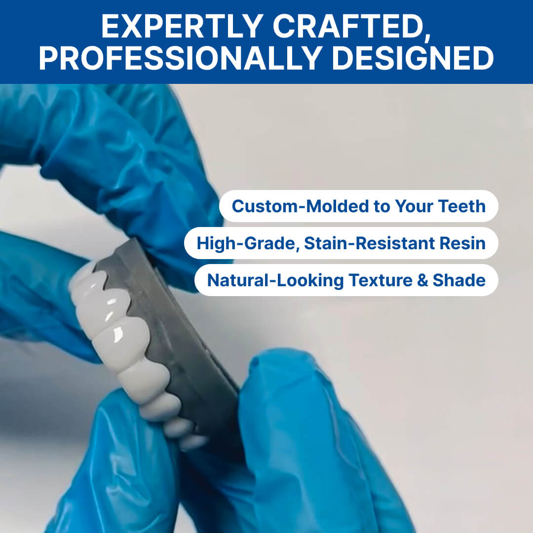 Shiny Smile Snap-On Veneers