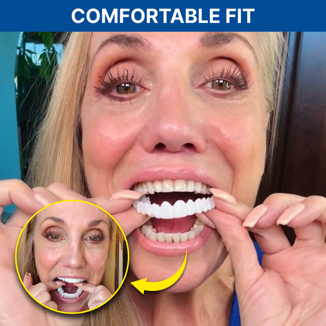 Shiny Smile Snap-On Veneers