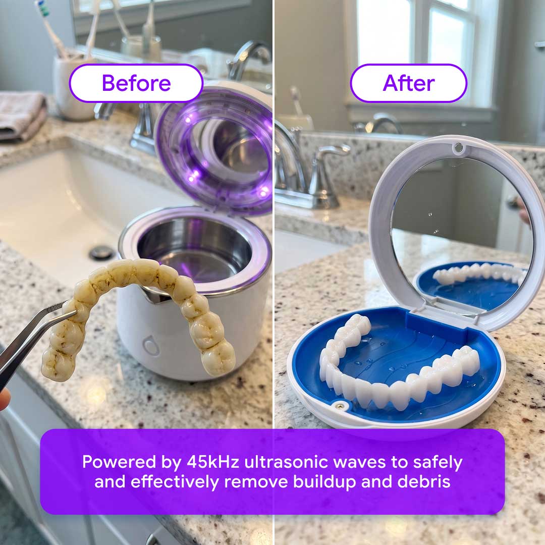 Shiny Smile Ultra Sonic Cleaner