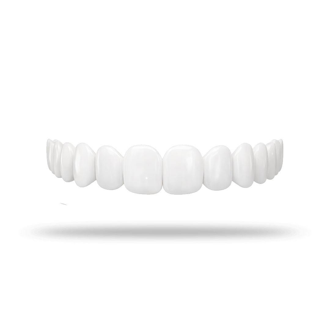 Shiny Smile Veneers protecting gums