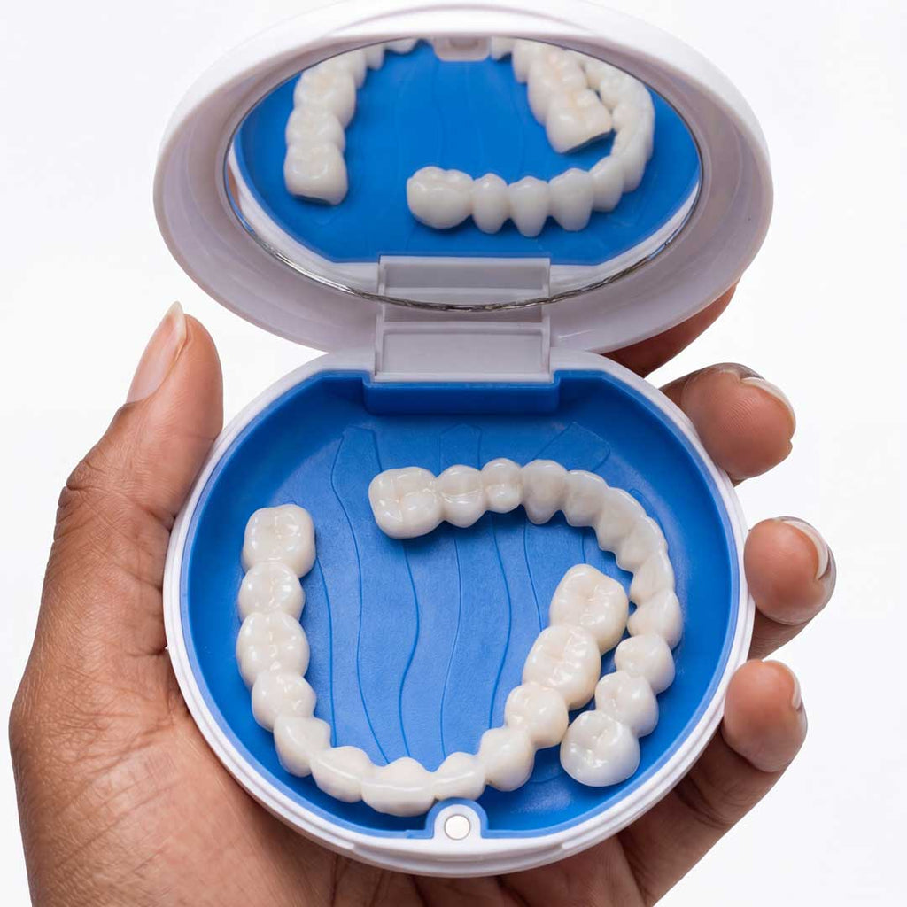Shiny Smile Veneers, Custom-Molded Snap-On Set